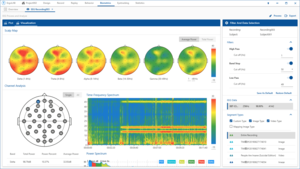 EEG脑电分析软件